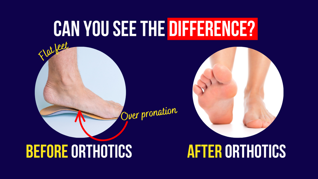 Orthotics Before and After