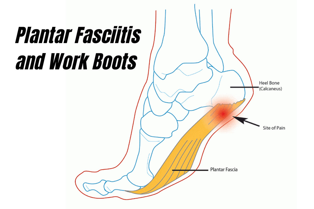 Plantar Fasciitis and Work Boots: Choosing the Right Support for Pain-Free Workdays