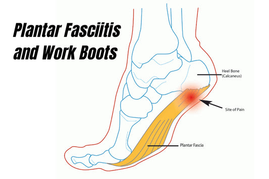 Plantar Fasciitis and Work Boots: Choosing the Right Support for Pain-Free Workdays