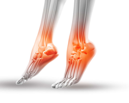 Relieve Arch Pain Fast with Orthotic Insoles