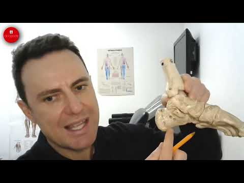 Heel Spurs vs Plantar Fasciitis: What's the Difference?