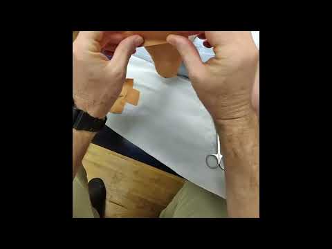 Modified Low Dye Taping for Plantar Fasciitis