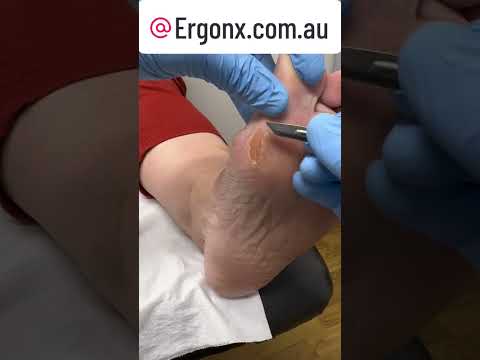 Smooth Transformation Foot Peel #FootCare #SkincareRoutine