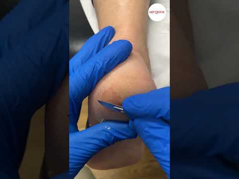 Winter Guide: Heal Cracked Heels Fast #WinterSkincare #HeelCare