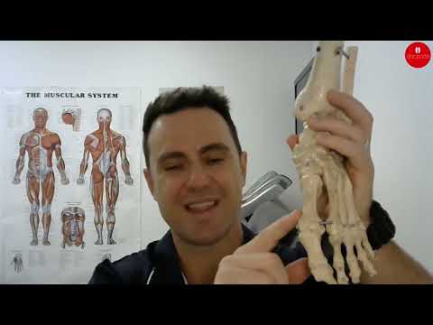 What Causes Bunions and How You Can Manage Them