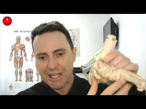 Orthotics for Plantar Fasciitis: What Should They Do?