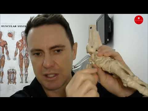 How Orthotics Help Flat Feet: Arch Support Explained