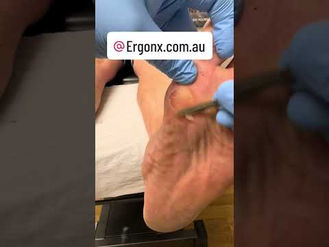 Relieve Foot Pain: Top Supportive Workboot Tips #FootCare #Workboots
