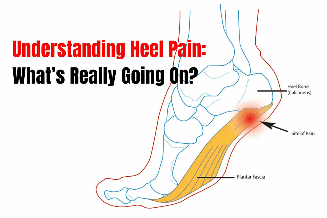 Why Do My Heels Hurt After a Long Day at Work?